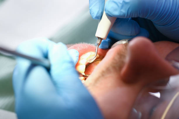 Best Emergency Gum Pain Relief  in Shanor Northvue, PA