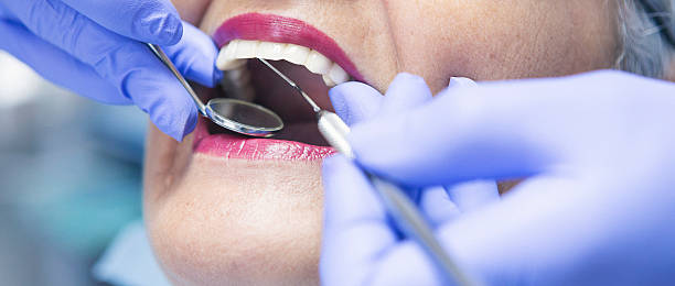 Best Knocked-Out Tooth Emergency  in Shanor Northvue, PA